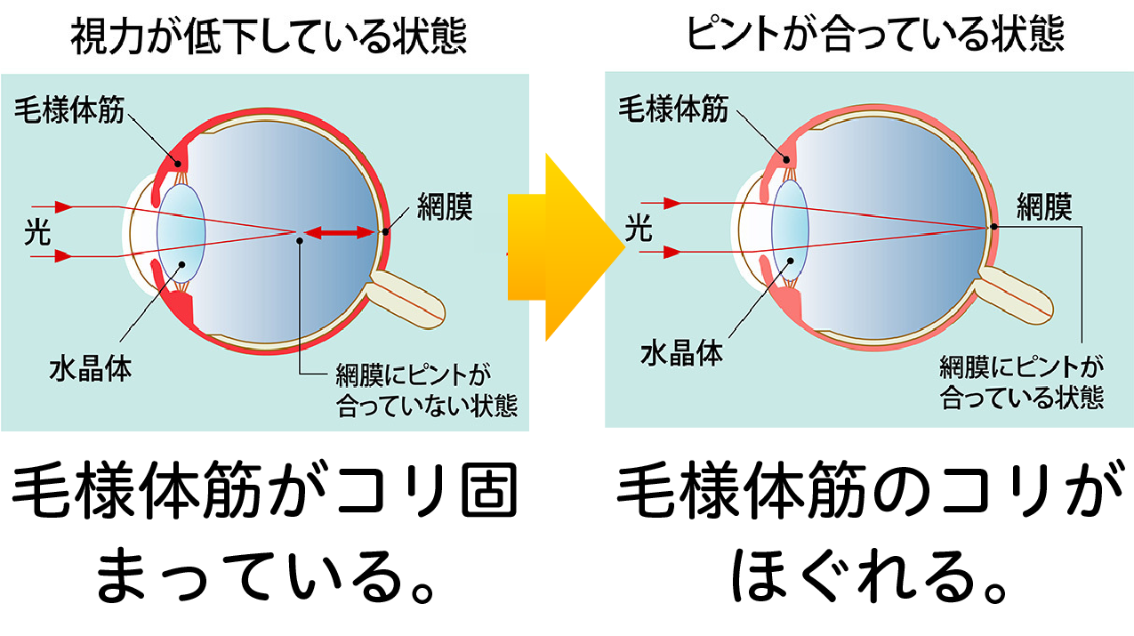 毛様体筋のコリがほぐれる